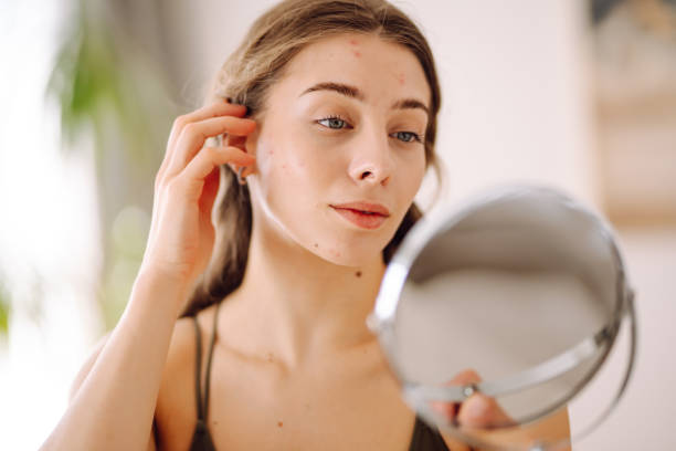istock Young woman with problem skin looking into mirror. 2159310595