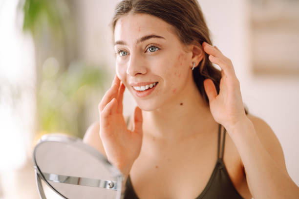 istock Young woman with problem skin looking into mirror. 2159310598