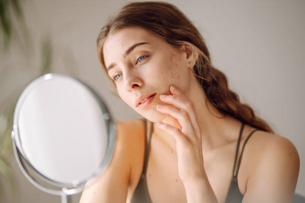 istock Young woman with problem skin looking into mirror. 2159310613