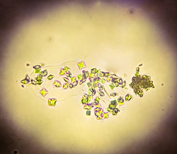 istock Calcium oxalate in urine sediment analysed by light microscope. 2159323468