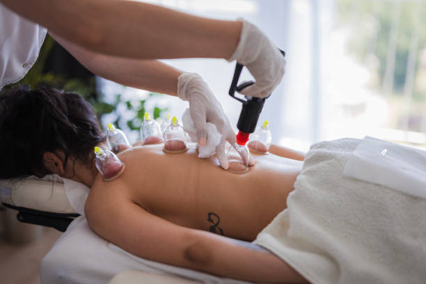 istock Hajamat therapist doing vacuum cupping therapy on patient 2159398480