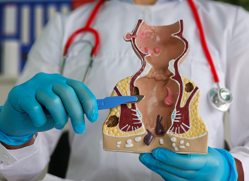 Que Significa Recto Médico Explicando La Anatomía Del Recto Y El Ano Utilizando Un Concepto ...
