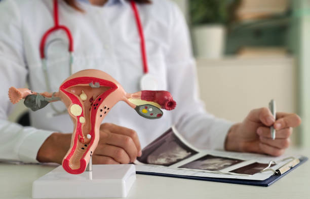 az orvos elmagyarázza a petefészkek változásait a betegnek a méh mesterséges modelljén, és ultrahangképet mutat - termékenység témájú stock jellegű vizuális alkotások, jogdíjmentes fotók és képek
