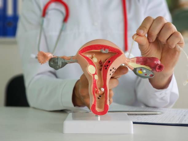 istock Anatomical structure of female uterus with adhesive plasters on fallopian tubes 2159622766