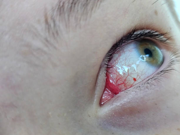 istock Closeup of red eye with a green iris 2159624816