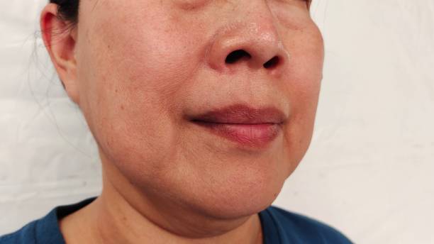 istock The Flabbiness and wrinkle. 2159653693