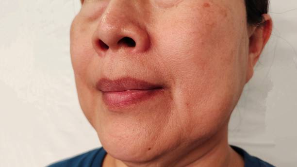 istock The Flabbiness and wrinkle. 2159653699
