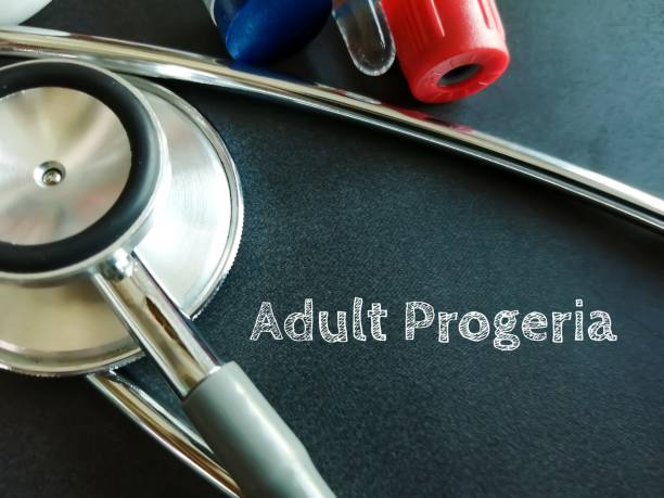 istock Werner syndrome (WS) or Werner's syndrome, also called adult progeria, a rare autosomal recessive disorder, medical conceptual image. 2159689708