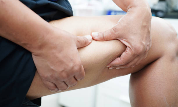 istock Asian woman with cellulite on leg skin fat, overweight problem. 2159696426