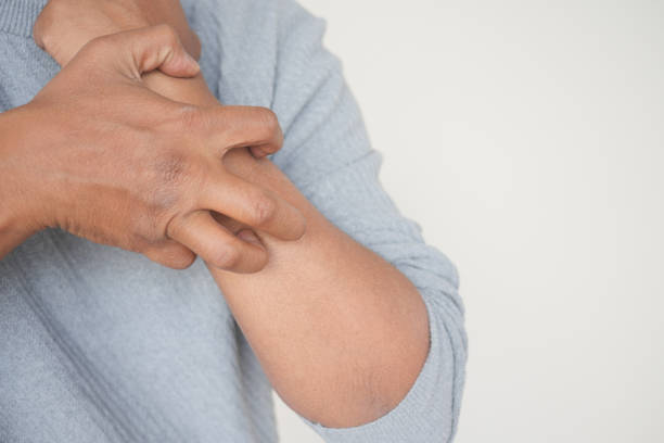 istock man suffering from itching skin, close up. 2159806185