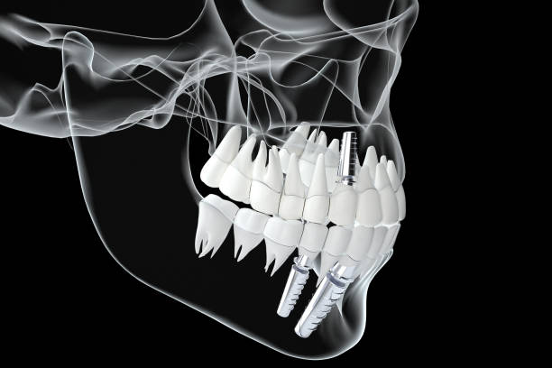 istock Dental Restoration Scene 2159915093