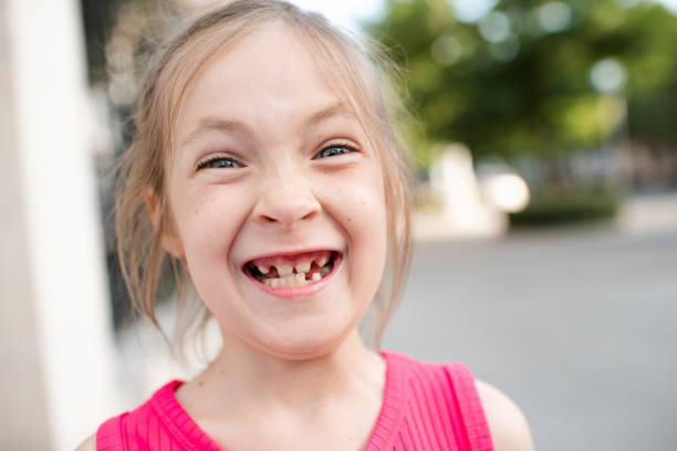 istock Funny kid girl with missing teeth outdoor 2160127319