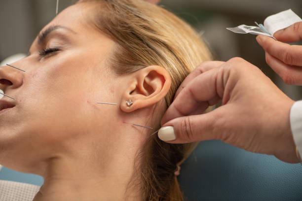 istock Acupuncture Treatment for facial spasms 2160198981