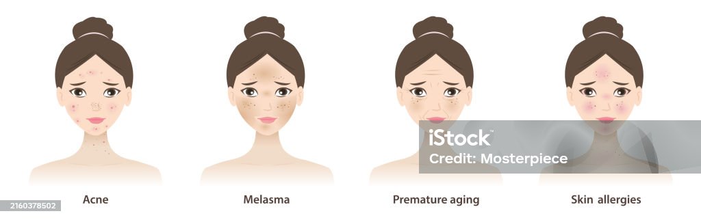 Skin Problem Female 202407types Of Skin Problems Stock Illustration - Download Image Now ...