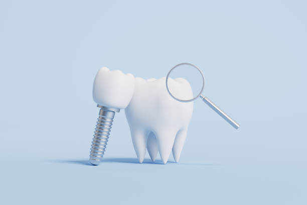istock 3d rendering tooth medical picture 2160387502