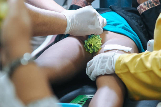 istock Circumcision in children, step by step procedure. Content is for educational purposes only. 2160532948