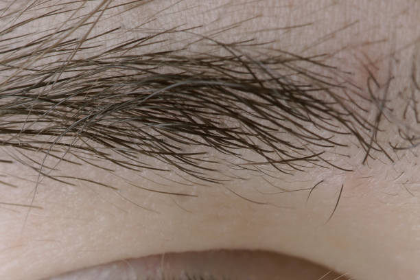 macro of unplucked eyebrow hairs