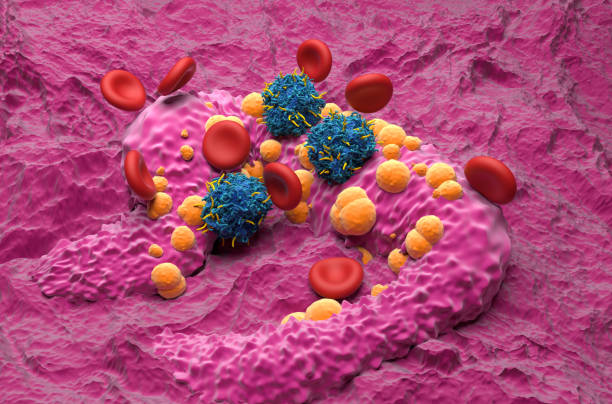 istock CAR T cell therapy in Basal-cell carcinoma (BCC) - isometric view 3d illustration 2160684796