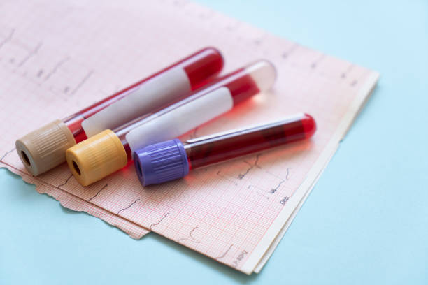 provette ematica - esami del sangue foto e immagini stock