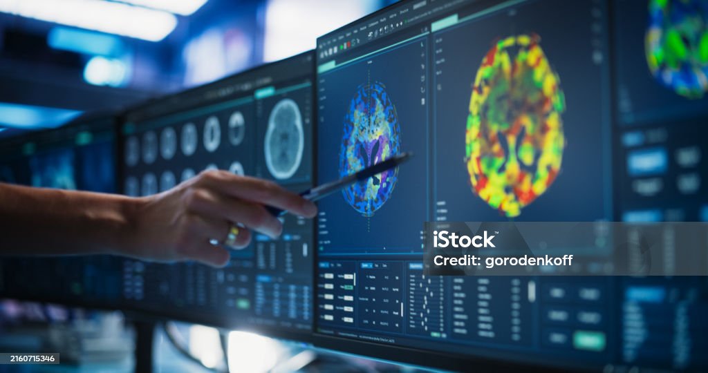 Modern Medical Research Center: Anonymous Doctor Pointing At Desktop Computer Monitor With CT Scan Of Patient's Spinal Cord. Specialist Looking For Tumors Or Damage, Looking For Treatment Methods. MRI Scan Stock Photo Modern Medical Research Center: Anonymous Doctor Pointing At Desktop Computer Monitor With CT Scan Of Patient's Spinal Cord. Specialist Looking For Tumors Or Damage, Looking For Treatment Methods. MRI Scan Stock Photo