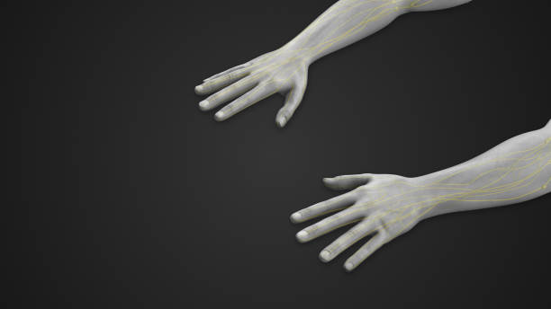istock Arm lymphedema disease or edema swollen hand 2160960307