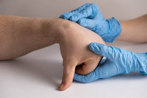 gangliová cysta nebo hygrom zápěstí na ruce pacienta mužského pohlaví, vyšetření lékařem - ganglion - stock snímky, obrázky a fotky