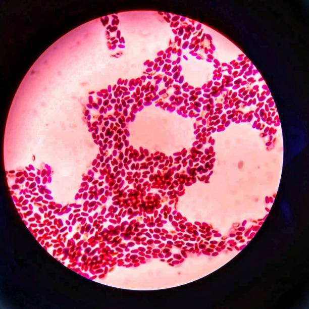 Branching budding yeast cells with pseudohyphae in gram stain fine with microscope.