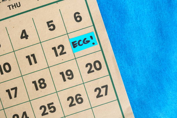 istock ECG test or electrocardiogram medical procedure schedule concept. Written reminder note on calendar. 2161291507