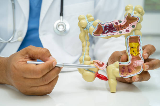 istock Intestine, appendix and digestive system, doctor holding anatomy model for study diagnosis and treatment in hospital. 2161497685