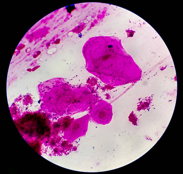 istock Epithelial cells, clue cells and Neisseria gonorrhoeae micrograph. 2161635322