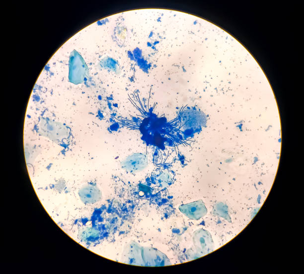 istock Trichomonas painted with methylene blue micrograph. 2161635750