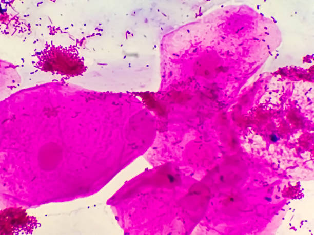istock Epithelial cells, clue cells and Neisseria gonorrhoeae micrograph. 2161637656