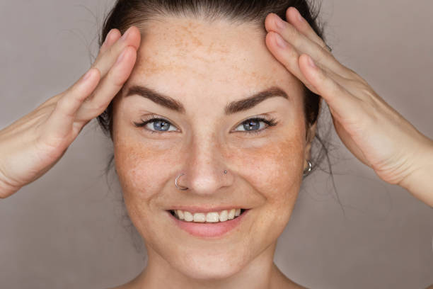 istock Caucasian woman's face with freckles or age spots 2161748023