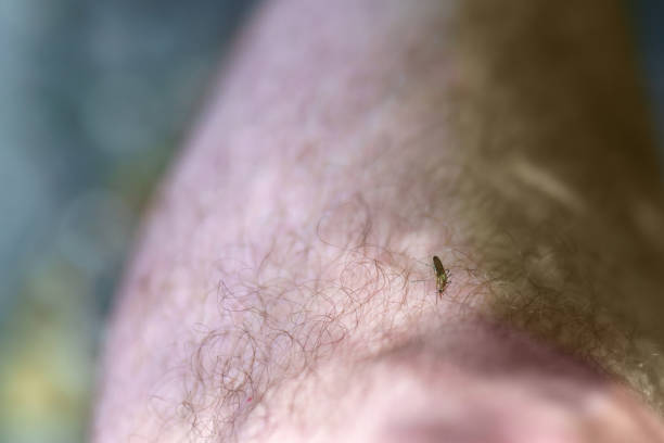istock Mosquito biting a man's leg with curly hair. 2161803829