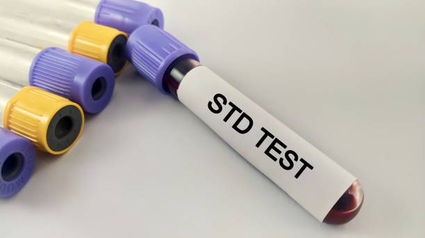 istock Tube with blood sample and label STD Test 2161856214