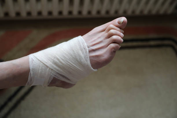 istock Foot in a bandage 2162016864