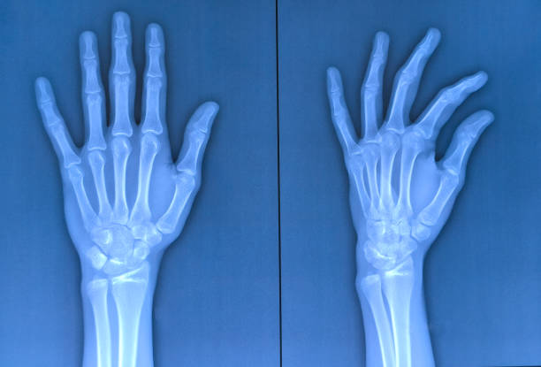 Reaching, skeleton hand isolated on white background
