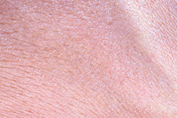 istock dry and dehydrated human skin texture background 2162174535