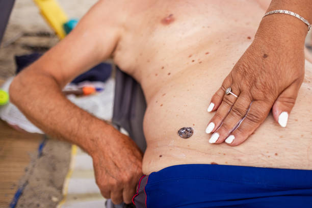A senior woman shows love and care by applying sunscreen to her husband's skin.