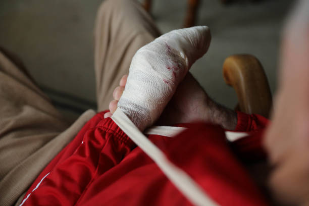 An elderly man with a hand injury, missing his thumb. His hand is bandaged, close up