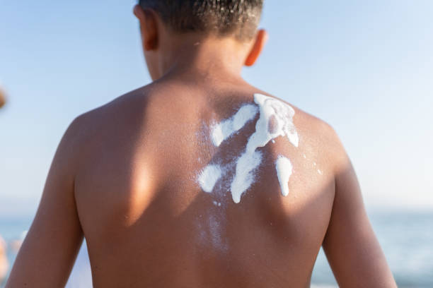 istock Sunscreen Cream On Child's Back At Beach 2162268686
