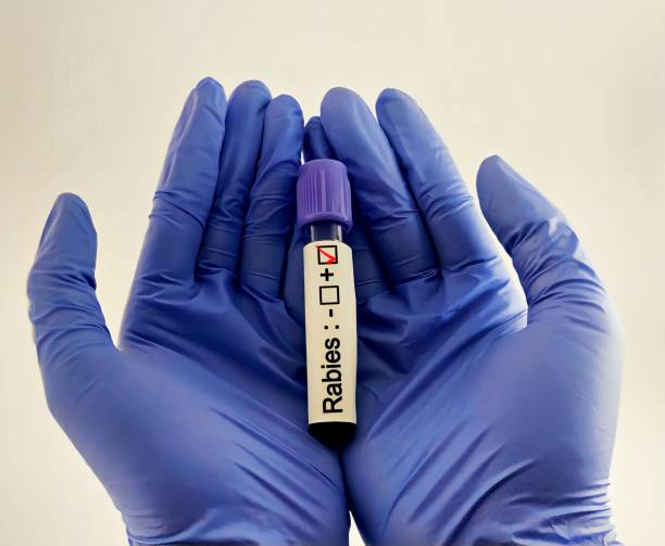 istock Blood sample positive with rabies virus 2162369894