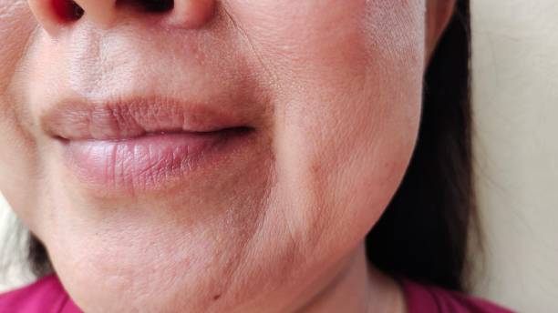 istock The wrinkle and Flabby skin. 2162389801