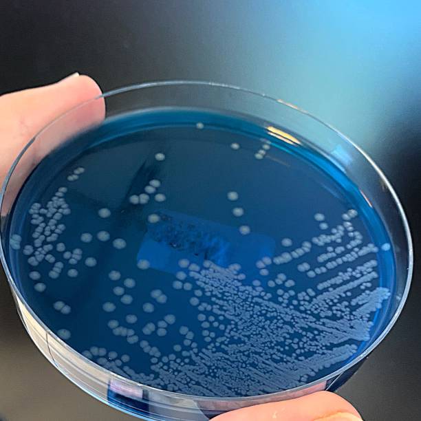 istock Proteus vulgaris grown on chromogenic agar plate 2162855769