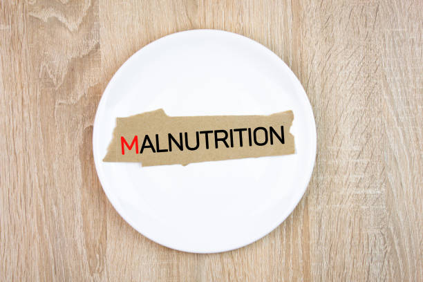 MALNUTRITION text,word on an empty plate on the table. Malnutrition symptom,concept.