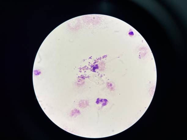 Microscopic Syphilis Sample 120+ Syphilis Microscope Stock Photos, Pictures & Royalty-Free Images ...
