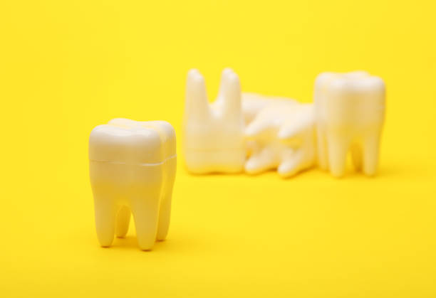 Plastic models of teeth on a yellow background