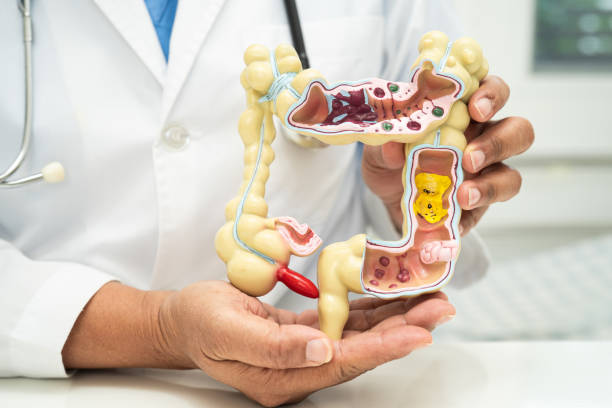 istock Intestine, appendix and digestive system, doctor holding anatomy model for study diagnosis and treatment in hospital. 2163398417