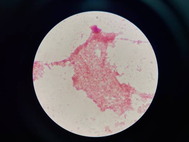istock Bacteria cell and white blood cell Hemoculture. 2163410129