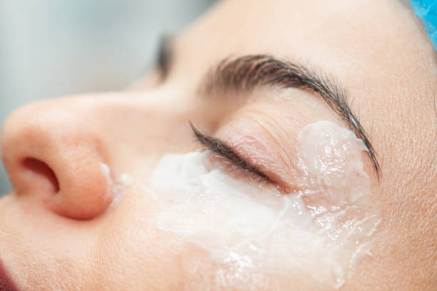 istock Application of topical anesthesia cream prior to a dermatological procedure. 2163506825